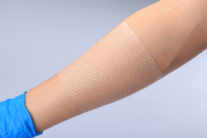 Skin Protection Fda Approved Iso/Ce Silicone Contact Layer