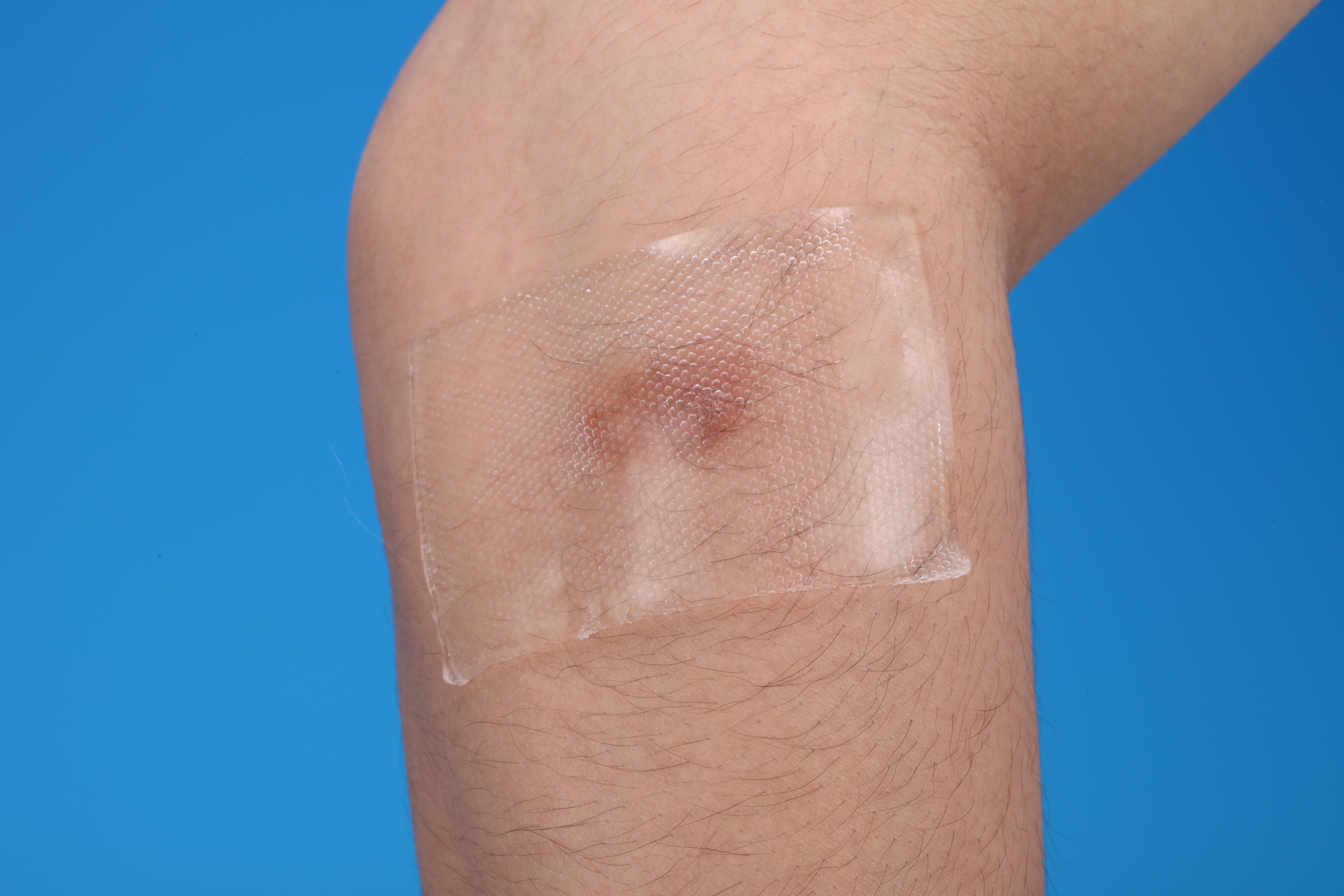 removal scar repeat use ISO/CE Silicone Scar Dressing