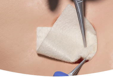 Cavity Wounds Waterproof Aliginate Fiber Alginate Dressing