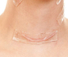 removal scar repeat use ISO/CE Silicone Scar Dressing