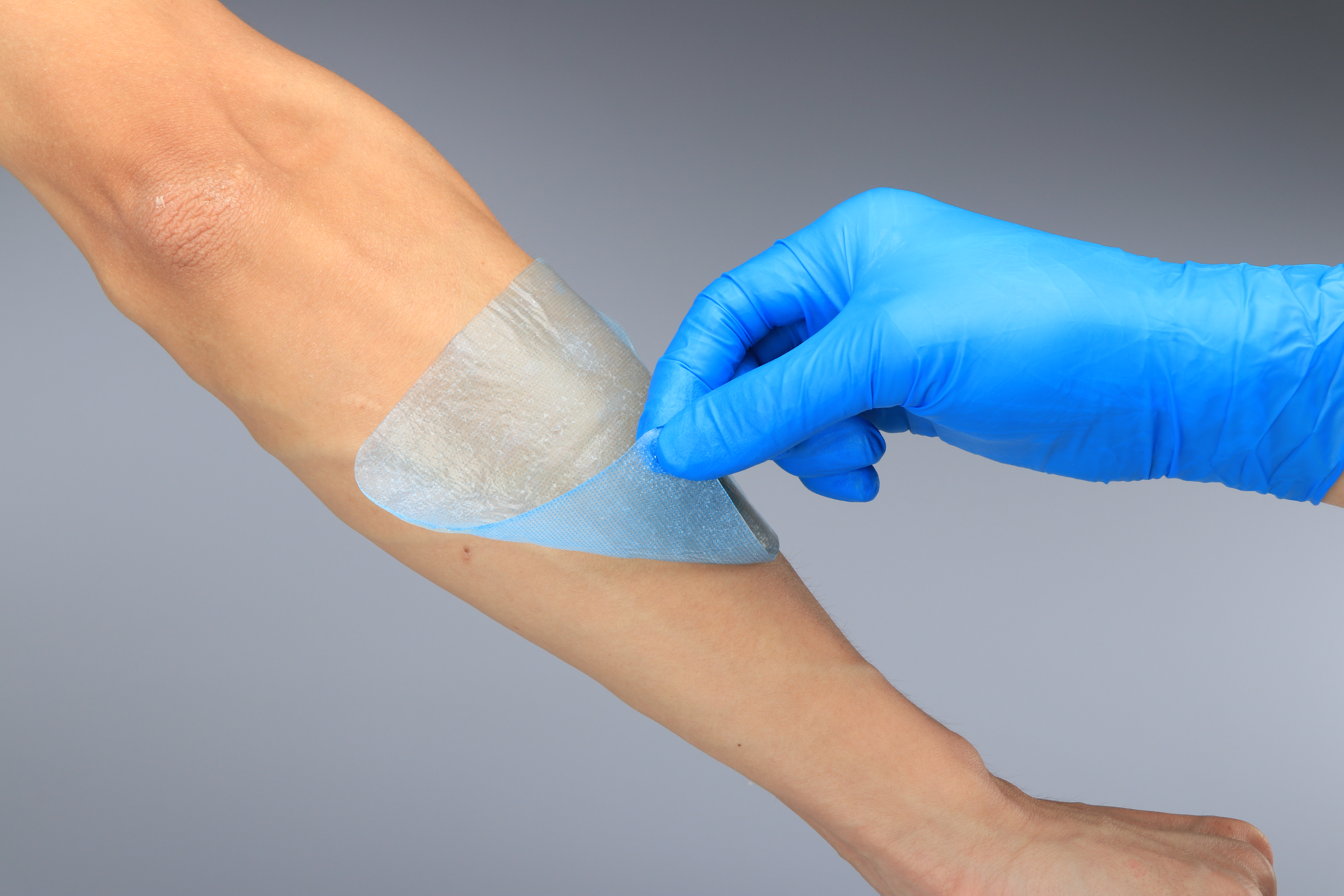 Pressure Ulcers Absorbent Medical Hydrogel Dressing With Border