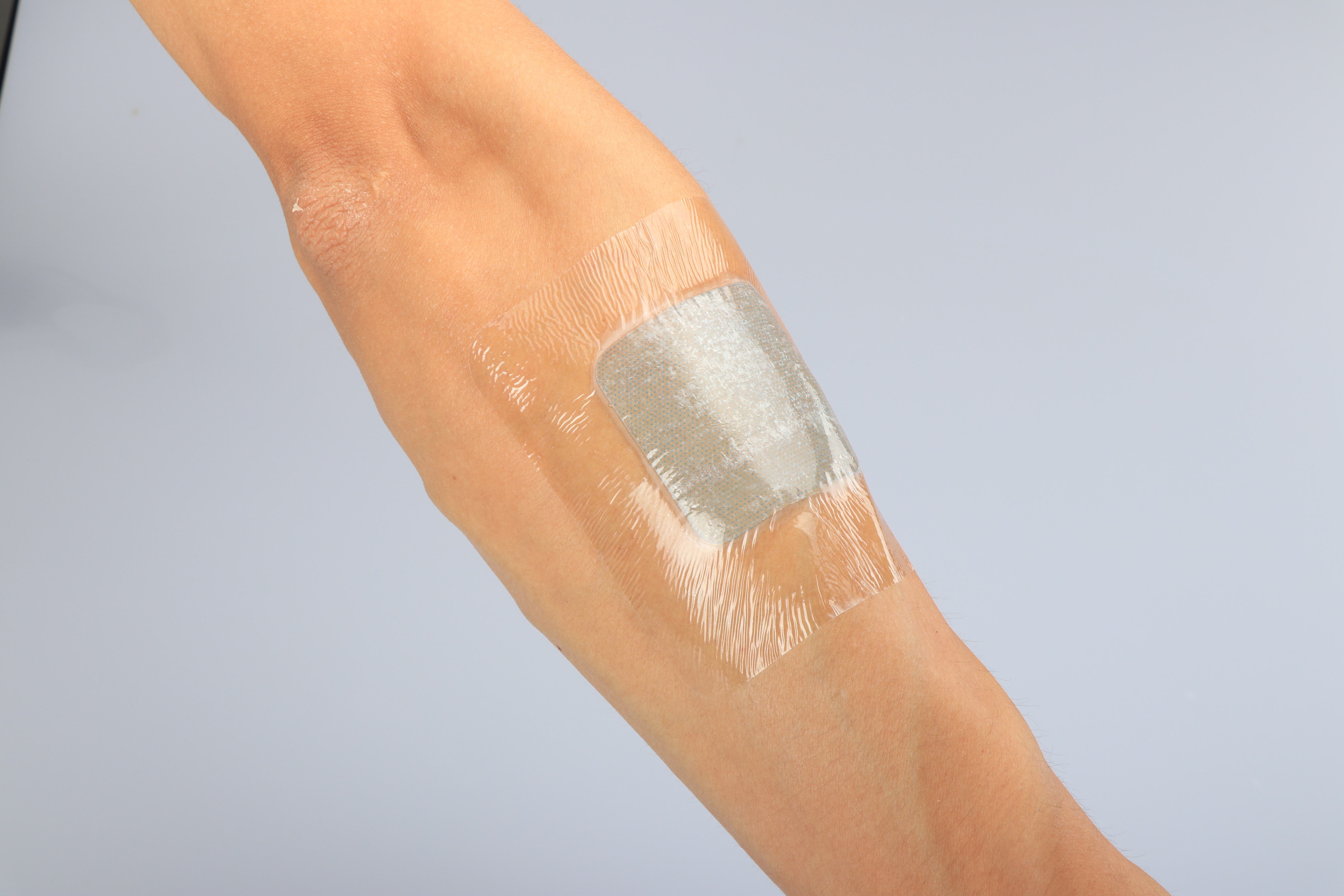 Pressure Ulcers Keto Friendly Medical Hydrogel Dressing With Adhesive